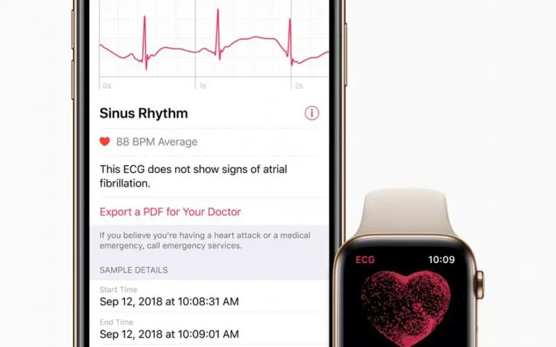 Come utilizzare l'applicazione ECG su Apple Watch