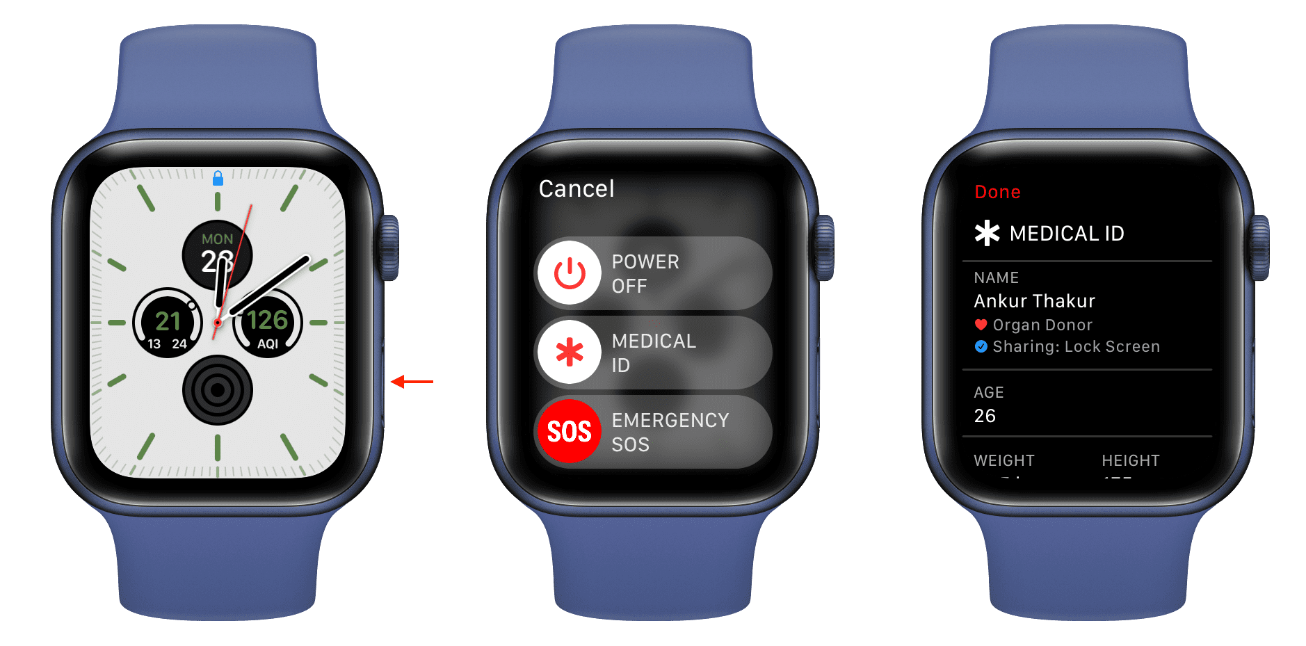 Vedi ID medico su Apple Watch