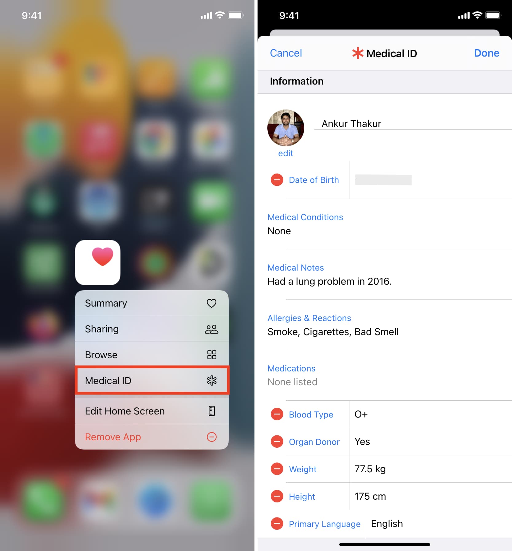Imposta ID medico su iPhone