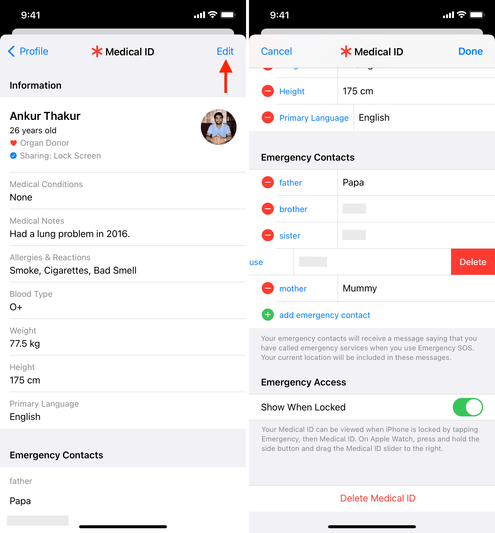 Modifica e aggiorna l'ID medico su iPhone